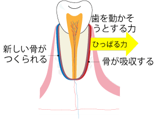 矯正治療の歯の動き